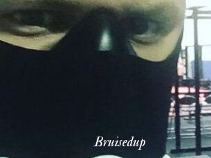 Bruisedup