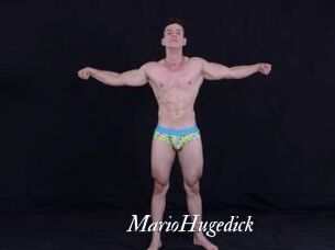 MarioHugedick
