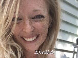 Xfreckledx